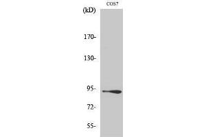 Western Blotting (WB) image for anti-Catenin, beta (CATNB) (Ser29) antibody (ABIN3183685) (beta Catenin Antikörper  (Ser29))