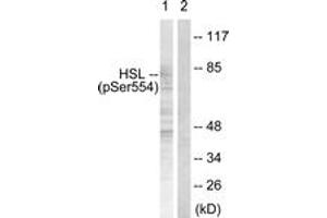 Western blot analysis of extracts from HeLa cells treated with Adriamycin 0. (LIPE Antikörper  (pSer855))