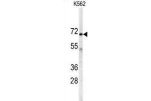 Western Blotting (WB) image for anti-Adenylate Kinase 7 (AK7) antibody (ABIN3002976) (Adenylate Kinase 7 Antikörper)