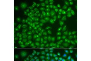 Immunofluorescence analysis of MCF-7 cells using RAB4A Polyclonal Antibody (Rab4 Antikörper)