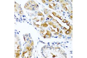 Immunohistochemistry of paraffin-embedded human stomach using CCL21 antibody (ABIN5970974) at dilution of 1/100 (40x lens). (CCL21 Antikörper)