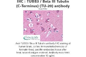 Image no. 2 for anti-Tubulin, beta 3 (TUBB3) (N-Term) antibody (ABIN1724161) (TUBB3 Antikörper  (N-Term))