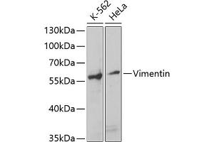 Western blot analysis of extracts of various cell lines, using Vimentin antibody (ABIN3016291, ABIN3016292, ABIN3016293 and ABIN6219693) at 1:1000 dilution. (Vimentin Antikörper  (AA 1-200))