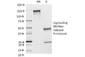 SDS-PAGE Analysis Purified CD54 Monoclonal Antibody (F4-31C2). (ICAM1 Antikörper)