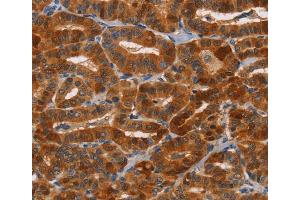 Immunohistochemistry (IHC) image for anti-Natural Cytotoxicity Triggering Receptor 1 (NCR1) antibody (ABIN2434406) (NCR1 Antikörper)