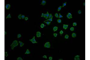 Immunofluorescence staining of HepG2 cells with ABIN7172751 at 1:100, counter-stained with DAPI. (YAP1 Antikörper  (AA 155-504))