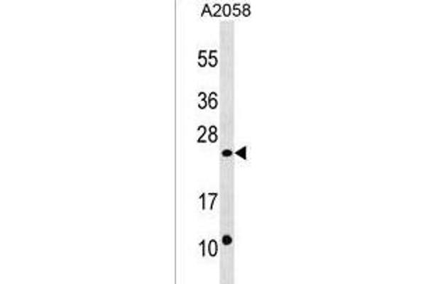 DUSP13 Antikörper  (C-Term)