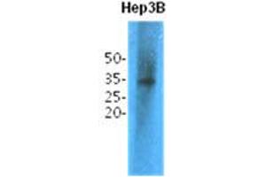 Western Blotting (WB) image for anti-Thiopurine S-Methyltransferase (TPMT) antibody (ABIN781550) (TPMT Antikörper)