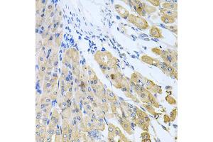 Immunohistochemistry of paraffin-embedded mouse stomach using CASP9 antibody. (Caspase 9 Antikörper)