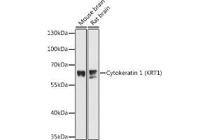 Western blot analysis of extracts of various cell lines, using Cytokeratin 1 (Cytokeratin 1 (KRT1)) antibody (ABIN6127738, ABIN6143011, ABIN6143012 and ABIN6215521) at 1:3000 dilution. (Cytokeratin 1 Antikörper  (AA 200-450))