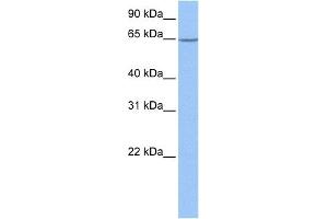 WB Suggested Anti-NOL5A Antibody Titration: 1 ug/mlPositive Control: 721_B cell lysate NOP56 is supported by BioGPS gene expression data to be expressed in 721_B (NOP56 Antikörper  (Middle Region))