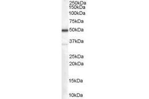 Western Blotting (WB) image for anti-Chromosome 4 Open Reading Frame 3 (C4ORF3) (Middle Region) antibody (ABIN2156498) (C4ORF3 Antikörper  (Middle Region))