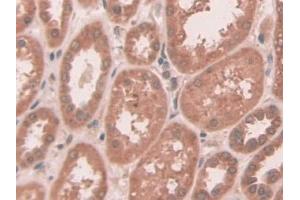 DAB staining on IHC-P; Samples: Human Kidney Tissue (ABCC10 Antikörper  (AA 1246-1492))