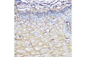 Immunohistochemistry of paraffin-embedded human esophageal using Annexin  Rabbit mAb (ABIN7265619) at dilution of 1:100 (40x lens). (Annexin A2 Antikörper)