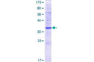 Image no. 1 for N-Acetyltransferase 8B (GCN5-Related, Putative, Gene/pseudogene) (NAT8B) (AA 1-143) protein (GST tag) (ABIN1312024) (NAT8B Protein (AA 1-143) (GST tag))