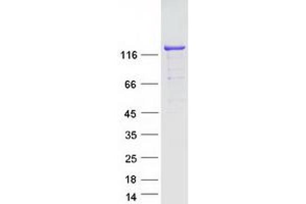 SRGAP1 Protein (Myc-DYKDDDDK Tag)