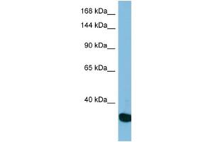 Western Blotting (WB) image for anti-Ubiquitin Specific Peptidase 36 (USP36) (N-Term) antibody (ABIN2501016) (USP36 Antikörper  (N-Term))