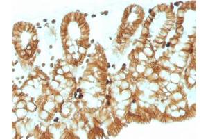 IHC testing of FFPE mouse colon tissue with EpCAM antibody. (EpCAM Antikörper  (Cytoplasmic Domain))