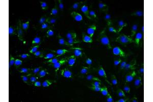 4 % Paraformaldehyde-fixed Human Umbilical Artery Endothelial Cells (HUAEC)probed with Anti-Vimentin Polyclonal Antibody, Alexa Fluor 488 conjugated (ABIN1695948) was used to stain the cell nuclei (Vimentin Antikörper  (AA 371-466))