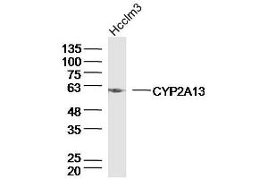 Hcclm3 lysates probed with CYP2A13 Polyclonal Antibody, Unconjugated  at 1:300 dilution and 4˚C overnight incubation. (CYP2A13 Antikörper  (AA 301-400))