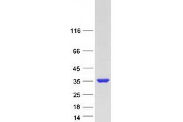 FAM9B Protein (Myc-DYKDDDDK Tag)