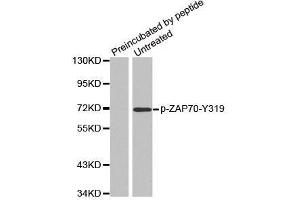 Western blot analysis of extracts from Jurkat cells, using phospho-ZAP70-Y319 antibody. (ZAP70 Antikörper  (pTyr319))