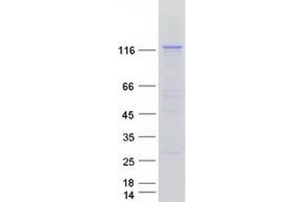 PLCL2 Protein (Transcript Variant 2) (Myc-DYKDDDDK Tag)