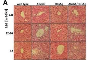 HBsAg expression elevates liver injury in Abcb4 knockout mice. (HBSAg Antikörper)