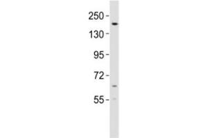 Western blot testing of KDM6B antibody at 1:2000 dilution + mouse lung lysate (Kdm6b Antikörper  (AA 879-912))