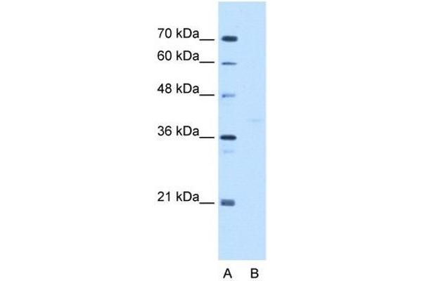 GMPPB Antikörper  (C-Term)