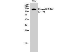 Western Blotting (WB) image for anti-Collagen, Type I, alpha 2 (COL1A2) (cleaved), (Gly1102) antibody (ABIN3181801) (COL1A2 Antikörper  (cleaved, Gly1102))