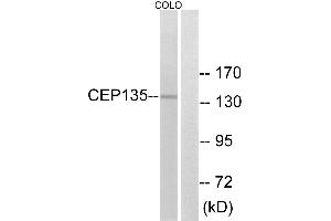 Western blot analysis of extracts from COLO cells, using CEP135 antibody. (CEP135 Antikörper)