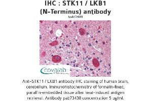 Image no. 2 for anti-serine/threonine Kinase 11 (STK11) antibody (ABIN1739721) (LKB1 Antikörper)