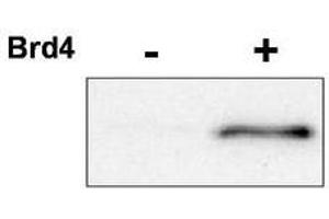 Image no. 1 for anti-Cyclin-Dependent Kinase 9 (CDK9) (pThr29) antibody (ABIN292281) (CDK9 Antikörper  (pThr29))