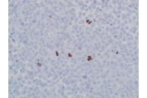 Image no. 1 for anti-Histone 3 (H3) (pSer10), (pSer28) antibody (ABIN952747) (Histone 3 Antikörper  (pSer10, pSer28))