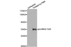 Western blot analysis of extracts from HeLa cells, using Phospho-LIMK2-T505 antibody (ABIN2988124). (LIMK2 Antikörper  (pThr505))