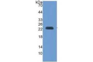 Western Blotting (WB) image for Vascular Cell Adhesion Molecule 1 (VCAM1) ELISA Kit (ABIN6730930)