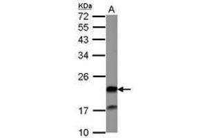 Image no. 1 for anti-Grancalcin, EF-Hand Calcium Binding Protein (GCA) (AA 7-217) antibody (ABIN1498410) (Grancalcin Antikörper  (AA 7-217))