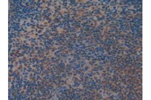 IHC-P analysis of Mouse Spleen Tissue, with DAB staining. (MEK2 Antikörper  (AA 44-313))