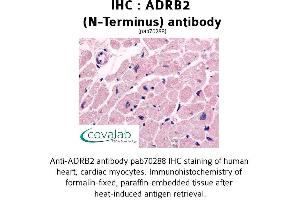 Image no. 1 for anti-Adrenergic, beta-2-, Receptor, Surface (ADRB2) (Extracellular Domain), (N-Term) antibody (ABIN1731583) (beta 2 Adrenergic Receptor Antikörper  (Extracellular Domain, N-Term))