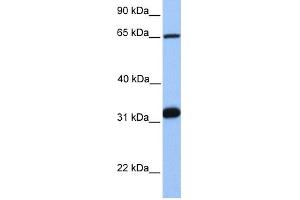 WB Suggested Anti-SF1 Antibody Titration:  0. (Splicing Factor 1 Antikörper  (C-Term))