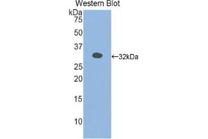 Detection of Recombinant MYLK3, Mouse using Polyclonal Antibody to Myosin Light Chain Kinase 3 (MYLK3) (MYLK3 Antikörper  (AA 488-750))