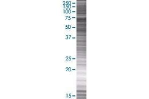 BRD3 transfected lysate. (BRD3 293T Cell Transient Overexpression Lysate(Denatured))