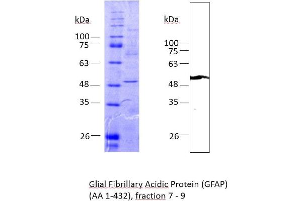 GFAP Protein (AA 1-432) (Strep Tag)