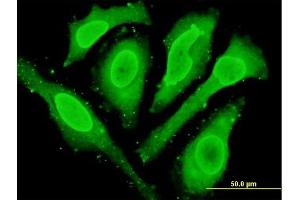 Immunofluorescence (IF) image for anti-Cytoglobin (CYGB) (AA 1-190) antibody (ABIN566715)