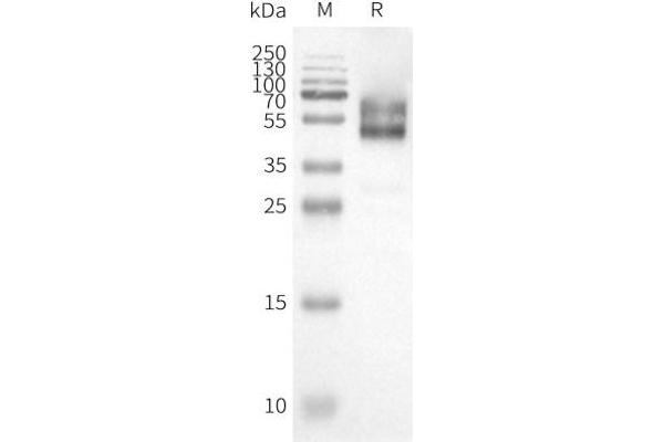 HCRTR1 Protein