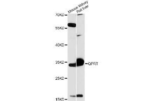 Western blot analysis of extracts of various cell lines, using QPRT antibody (ABIN6290813) at 1:3000 dilution. (QPRT Antikörper)