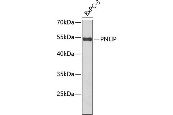 PNLIP Antikörper  (AA 166-465)