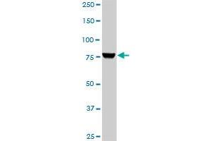 Western Blotting (WB) image for anti-Phosphoinositide 3 Kinase, p85 alpha (PI3K p85a) (AA 1-454) antibody (ABIN518903)