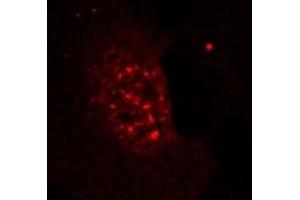 Image no. 3 for anti-V-Akt Murine Thymoma Viral Oncogene Homolog 1 (AKT1) (pThr308) antibody (ABIN196711) (AKT1 Antikörper  (pThr308))